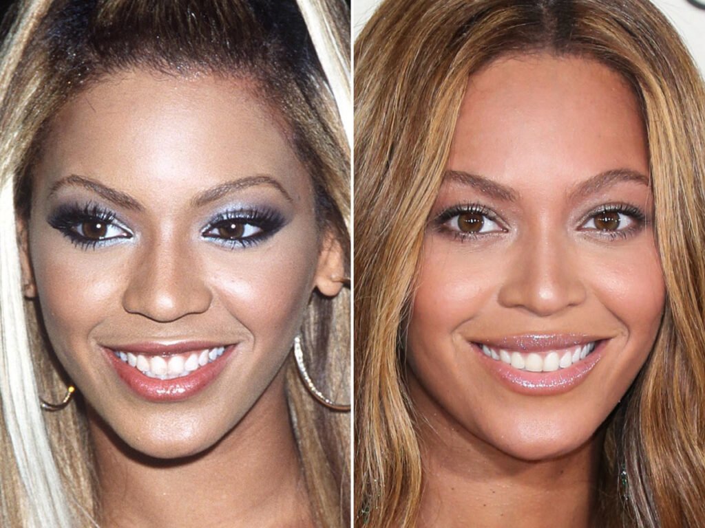 Beyonce Before and After Glutathione