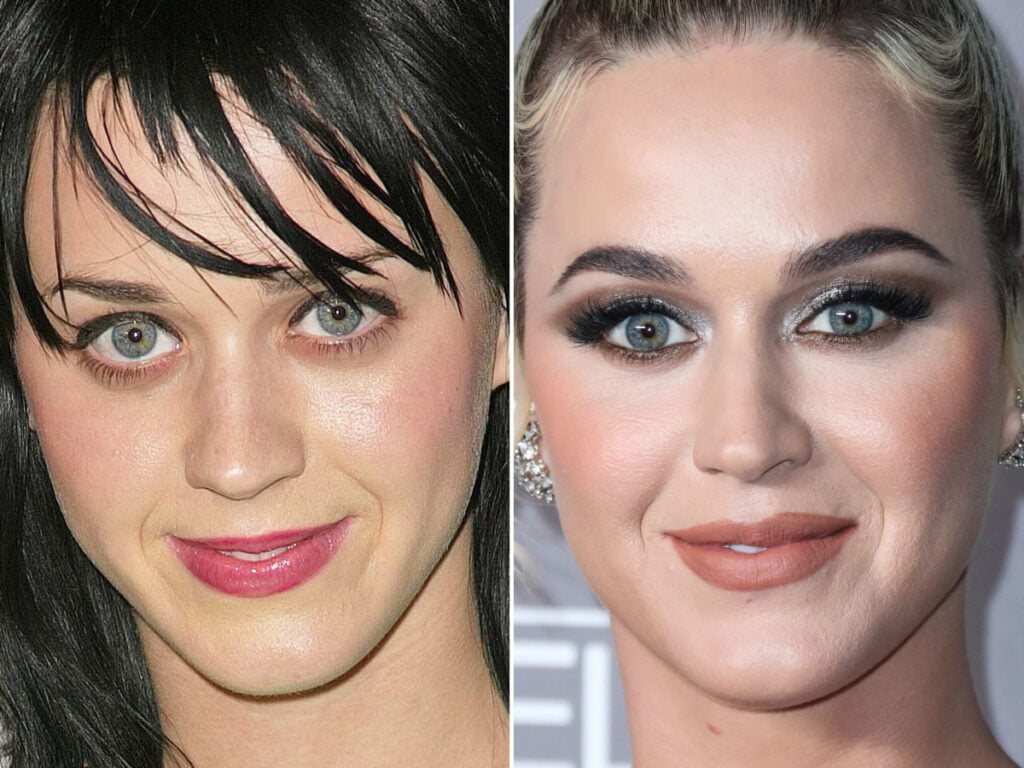 Katy Perry Before and After Glutathione IV Vitamin Therapy